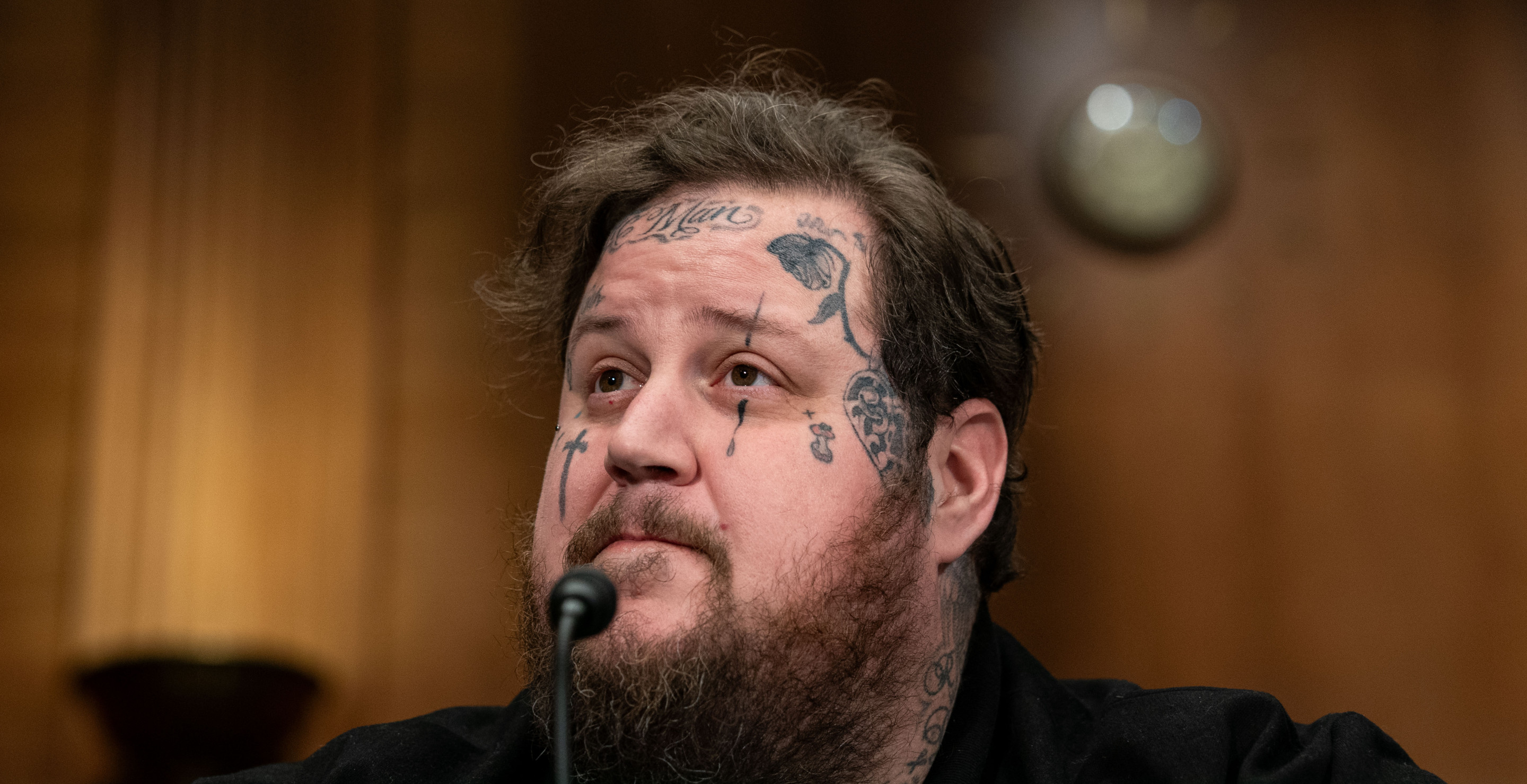 Jelly Roll Says He Got Infections From Bad Tattoos In The Past